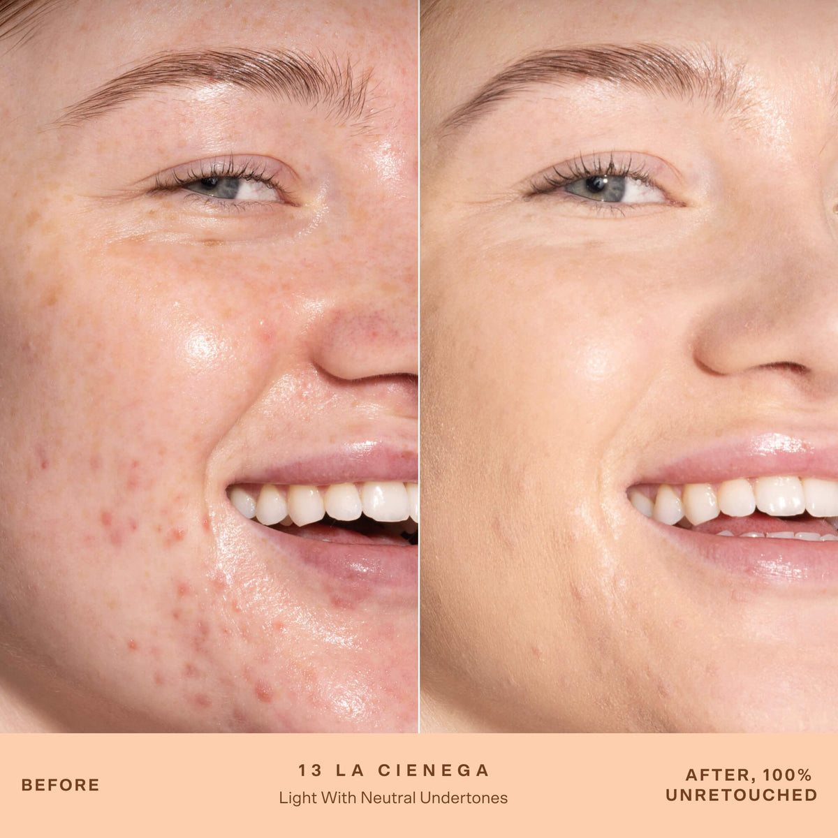 SunnyDays™ Tinted SPF 30 X5