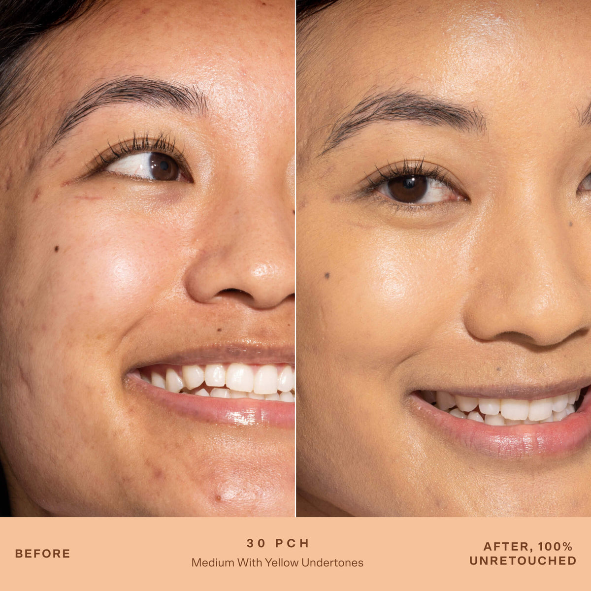 SunnyDays™ Tinted SPF 30 X5