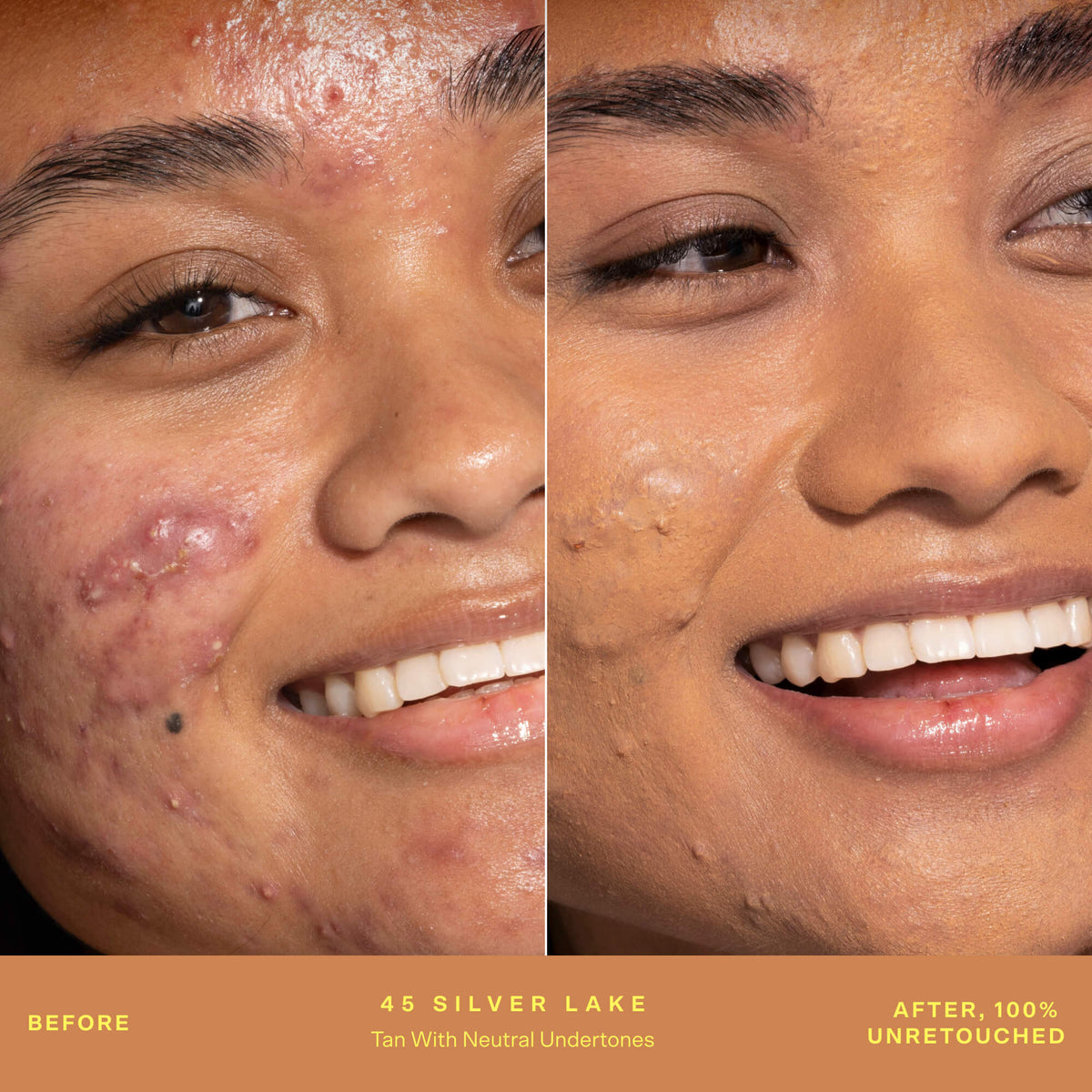 SunnyDays™ Tinted SPF 30 X5