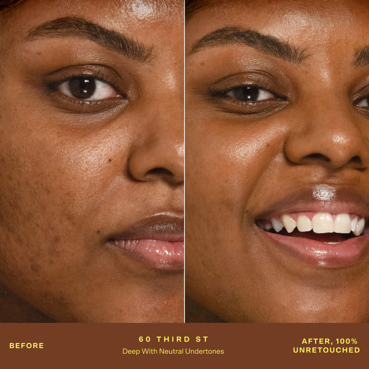 SunnyDays™ Tinted SPF 30 X5
