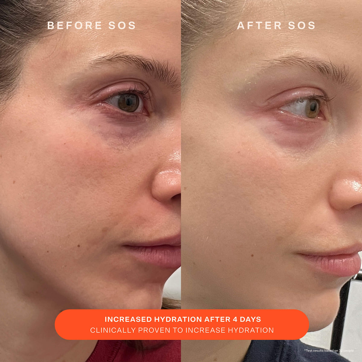 SOS Recovery Cream F8