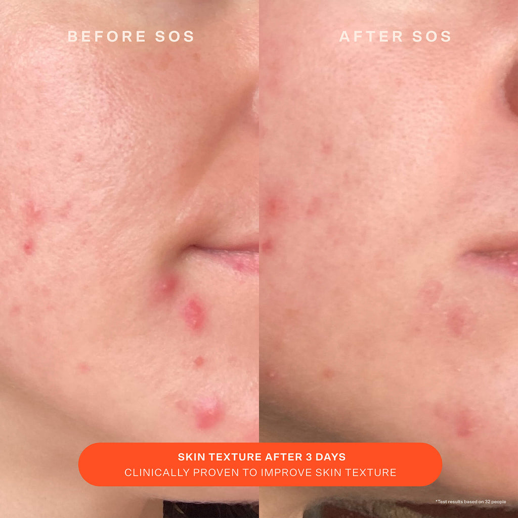 SOS Recovery Cream F8