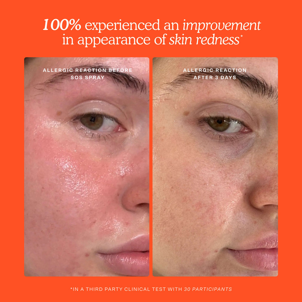 SOS Skincare Minis Kit Q1