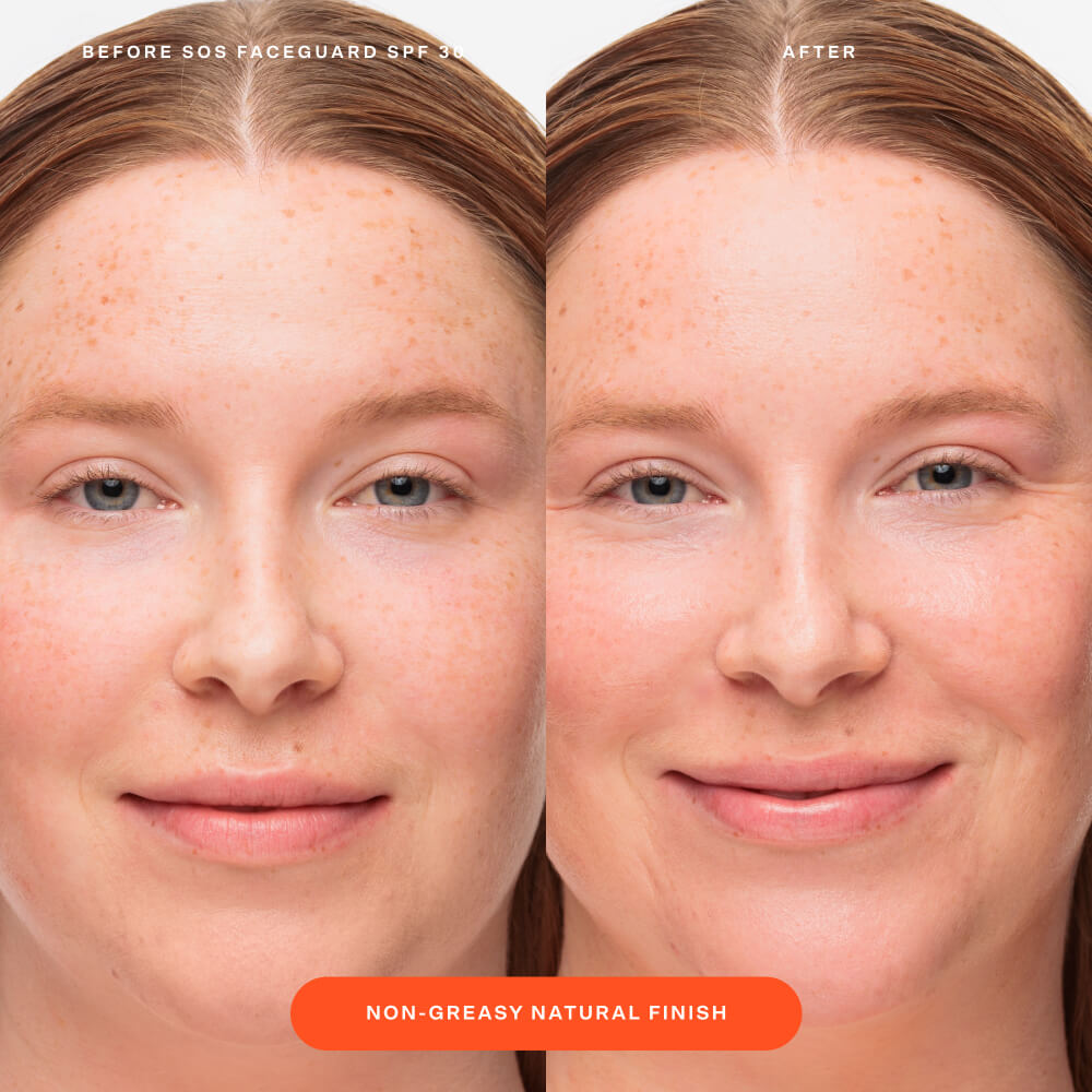 SOS FaceGuard™ SPF 30 Sunscreen PA+++ Y9