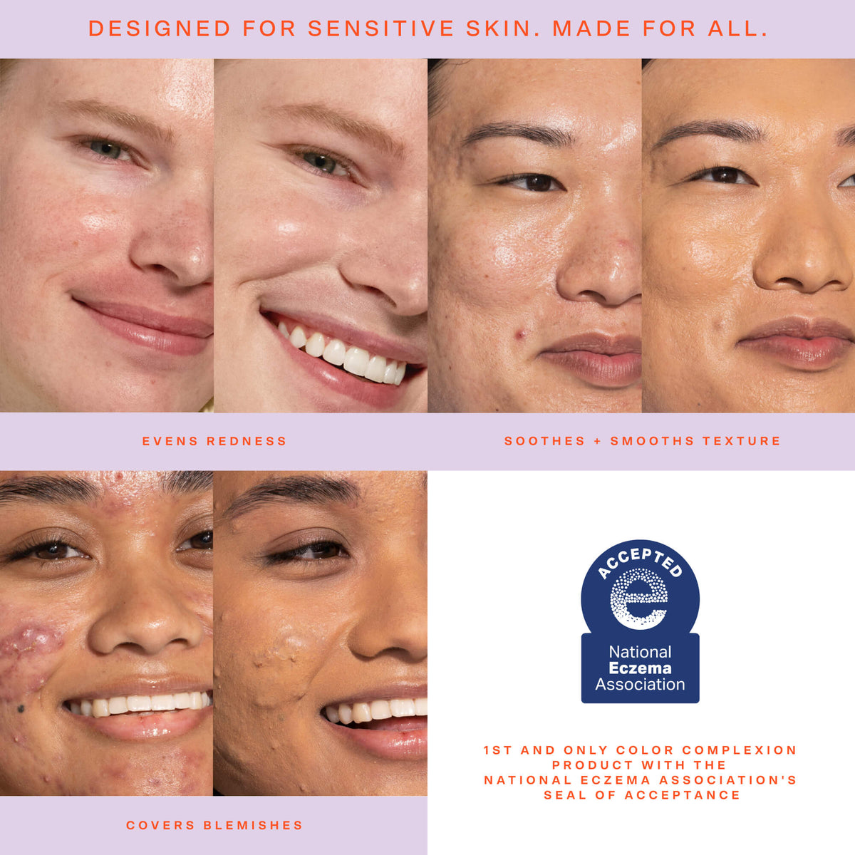 SunnyDays™ Tinted SPF 30 X5