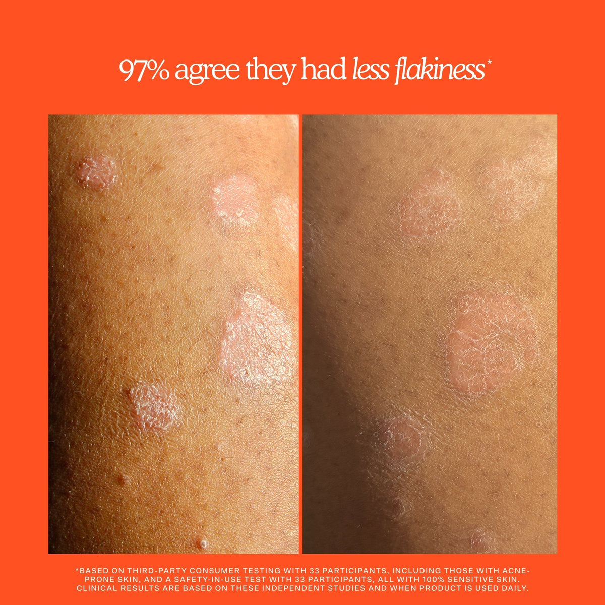 SOS Rescue + Relief Body Wash Treatment B1